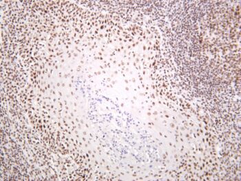 Nucleolin Rabbit Monoclonal Antibody - Image 2