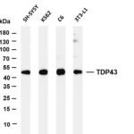 TDP43 Rabbit Monoclonal Antibody