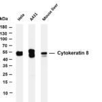 Cytokeratin 8 Rabbit Monoclonal Antibody