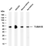 TUBA1B Rabbit Monoclonal Antibody