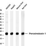 Peroxiredoxin 1 Rabbit Monoclonal Antibody