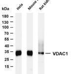 VDAC1 Rabbit Monoclonal Antibody
