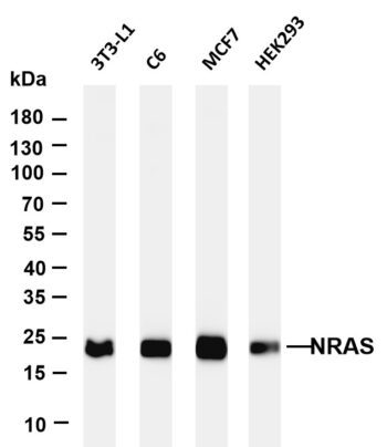 NRAS Rabbit Monoclonal Antibody