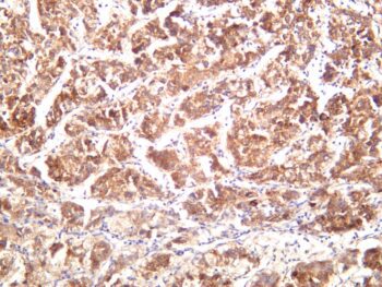 GRP78/BiP Rabbit Monoclonal Antibody - Image 2
