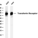 Transferrin Receptor Rabbit Monoclonal Antibody