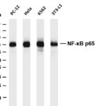 NF-κB p65 Rabbit Monoclonal Antibody
