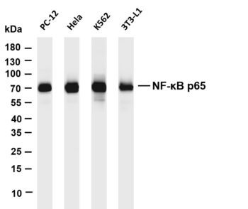 NF-κB p65 Rabbit Monoclonal Antibody