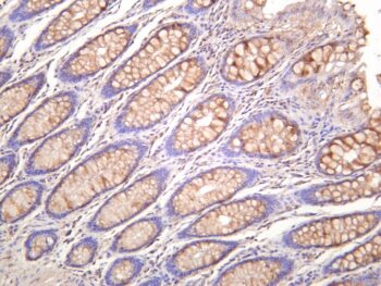 NF-κB p65 Rabbit Monoclonal Antibody - Image 2