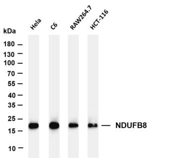 NDUFB8 Rabbit Monoclonal Antibody