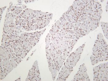 HP1α Rabbit Monoclonal Antibody - Image 2