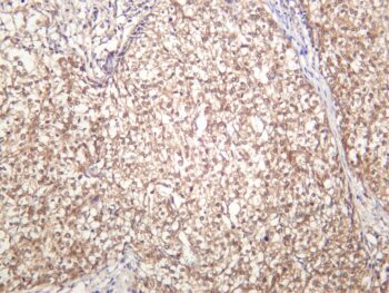 GSK3α Rabbit Monoclonal Antibody - Image 2