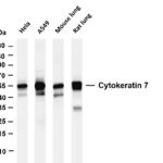 Cytokeratin 7 Rabbit Monoclonal Antibody