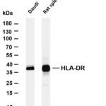HLA-DR Rabbit Monoclonal Antibody