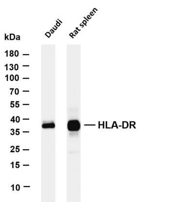 HLA-DR Rabbit Monoclonal Antibody