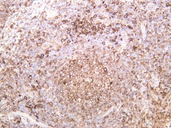 HLA-DR Rabbit Monoclonal Antibody - Image 2