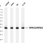 RPA32/RPA2 Rabbit Monoclonal Antibody
