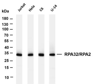 RPA32/RPA2 Rabbit Monoclonal Antibody
