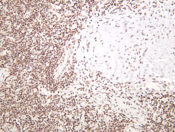 RPA32/RPA2 Rabbit Monoclonal Antibody - Image 2
