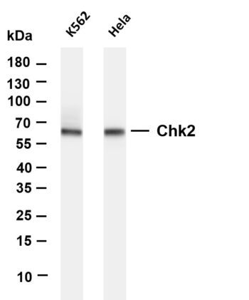 Chk2 Rabbit Monoclonal Antibody
