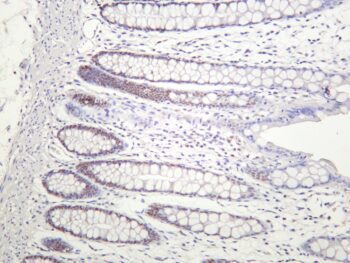Chk2 Rabbit Monoclonal Antibody - Image 2