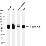 Cyclin A2 Rabbit Monoclonal Antibody