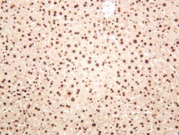 HDAC1 Rabbit Monoclonal Antibody - Image 2