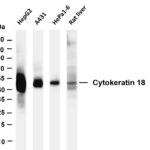 Cytokeratin 18 Rabbit Monoclonal Antibody