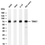 TAK1 Rabbit Monoclonal Antibody
