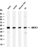 MEK1 Rabbit Monoclonal Antibody
