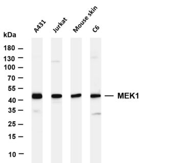 MEK1 Rabbit Monoclonal Antibody