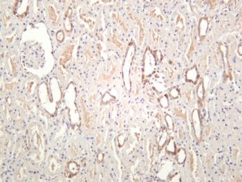 MEK1 Rabbit Monoclonal Antibody - Image 2