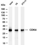 CDK4 Rabbit Monoclonal Antibody
