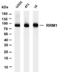 RRM1 Rabbit Monoclonal Antibody