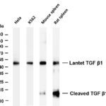 TGF β1 Rabbit Monoclonal Antibody