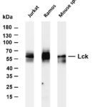 Lck Rabbit Monoclonal Antibody