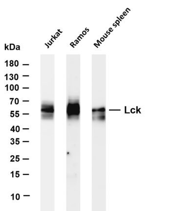 Lck Rabbit Monoclonal Antibody