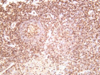Lck Rabbit Monoclonal Antibody - Image 2