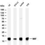 MIF Rabbit Monoclonal Antibody