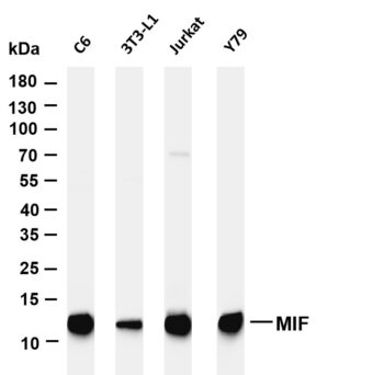 MIF Rabbit Monoclonal Antibody