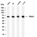 PAK1 Rabbit Monoclonal Antibody