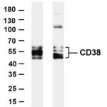 CD38 Rabbit Monoclonal Antibody