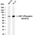 AKT (Phospho-Ser473) Rabbit Monoclonal Antibody