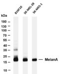 MelanA Rabbit Monoclonal Antibody