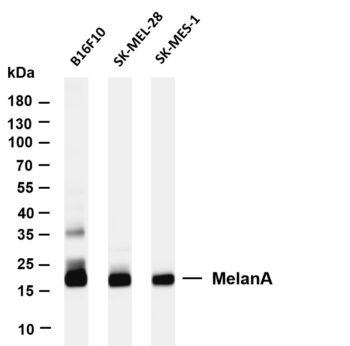 MelanA Rabbit Monoclonal Antibody