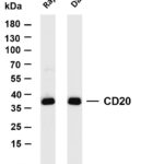 CD20 Rabbit Monoclonal Antibody