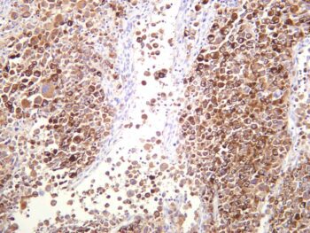 MelanA Rabbit Monoclonal Antibody - Image 2