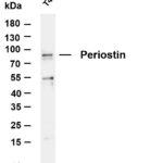 Periostin Rabbit Monoclonal Antibody