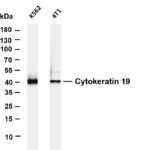 Cytokeratin 19 Rabbit Monoclonal Antibody