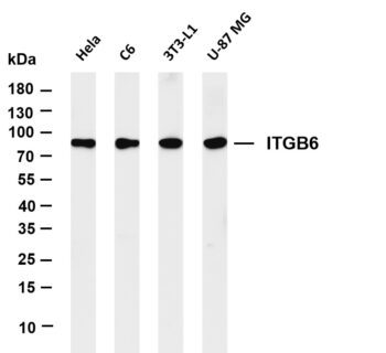 ITGB6 Rabbit Monoclonal Antibody