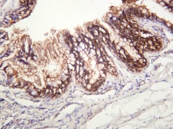 ITGB6 Rabbit Monoclonal Antibody - Image 2